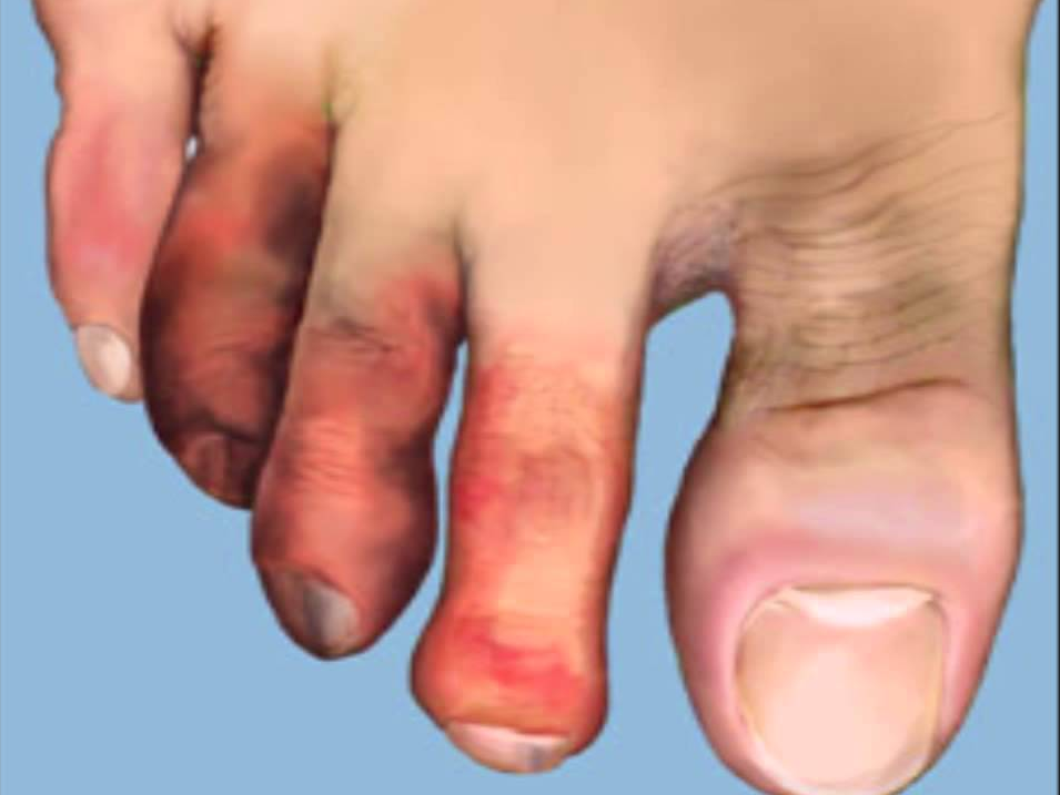 Vascular Pain Spine specialist doctor in surat